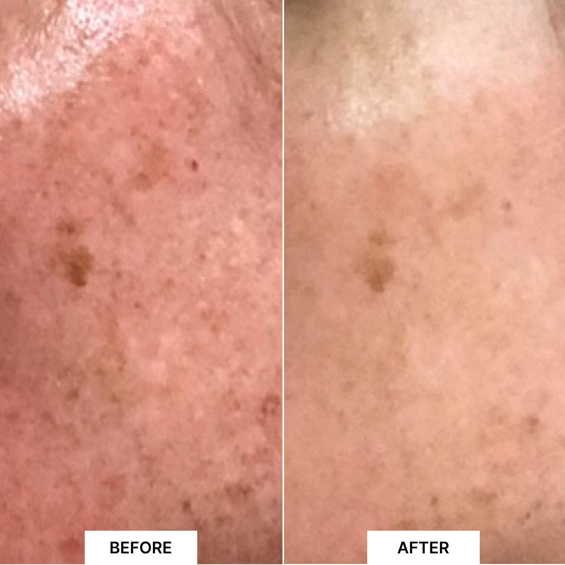 Pack Lift & Glow Xmas Edition