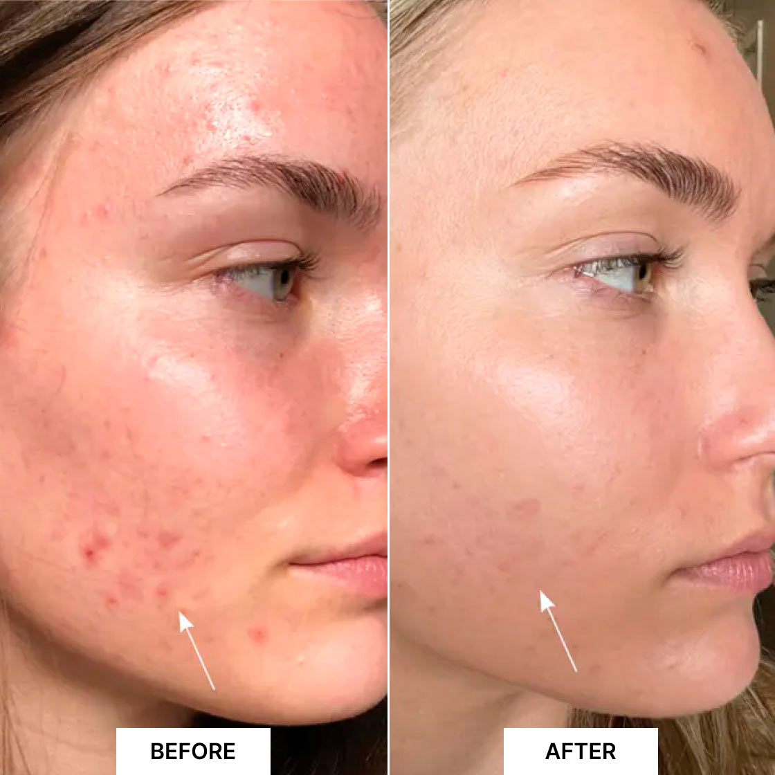 Pack Detox & Glow Xmas Edition