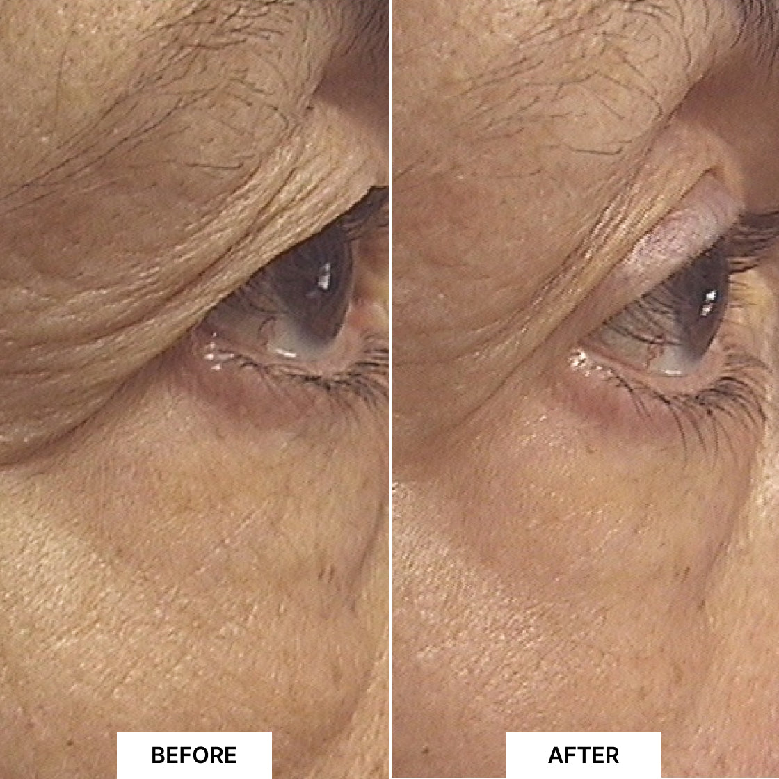 Pack Lift & Glow Xmas Edition