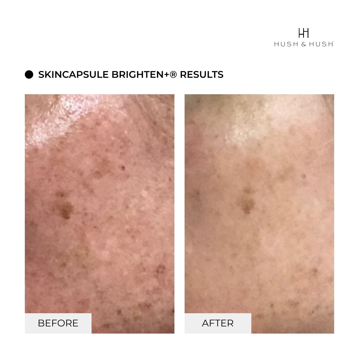 TimeCapsule & SC Brighten +