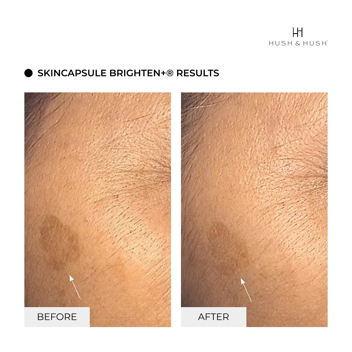 SkinCapsule BRIGHTEN+