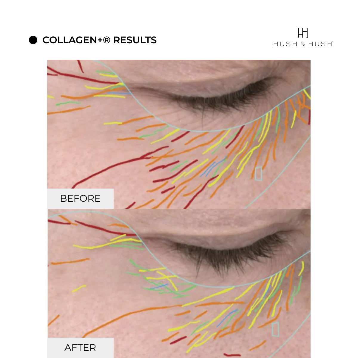 Collagen+