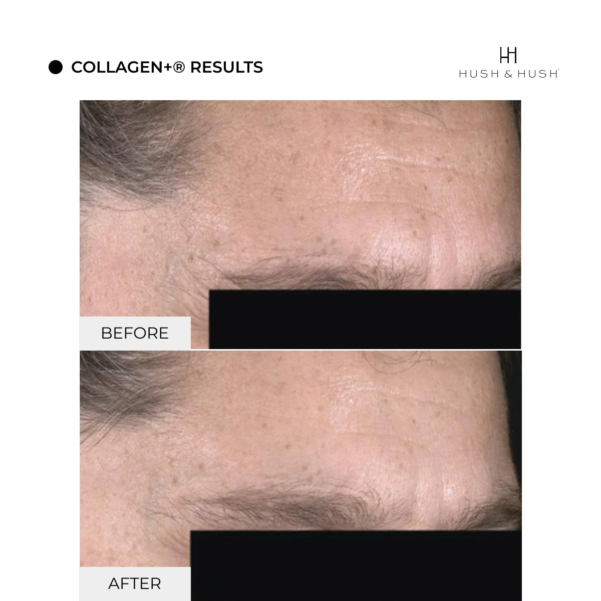 Collagen+