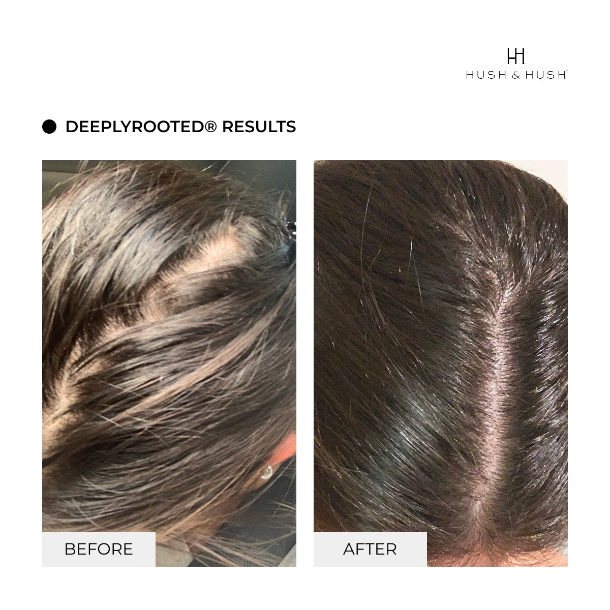 Acondicionador DeeplyRooted®