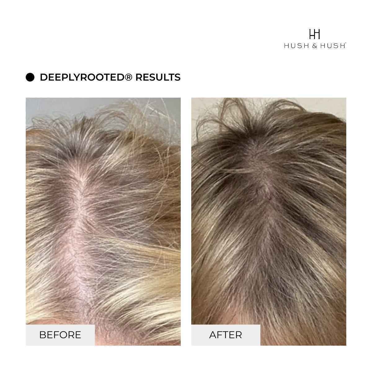 Sérum DeeplyRooted®