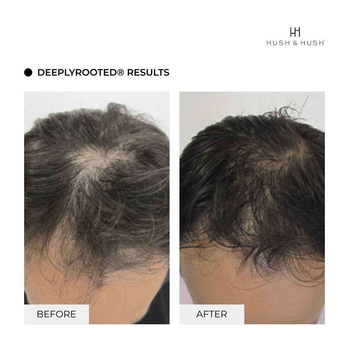 Sérum DeeplyRooted®