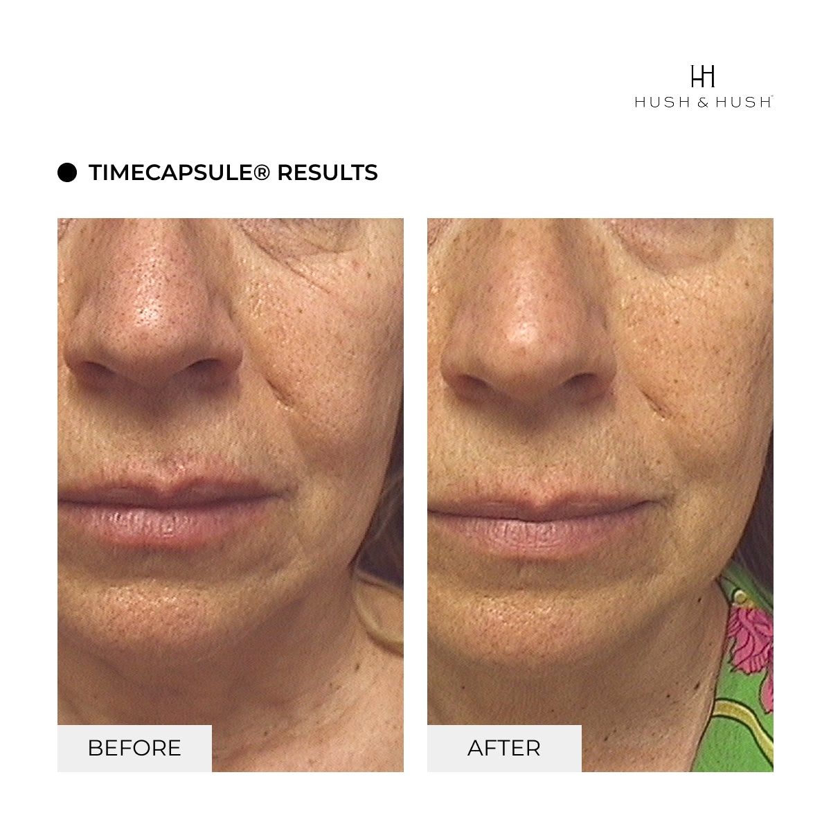 ShieldUp & TimeCapsule